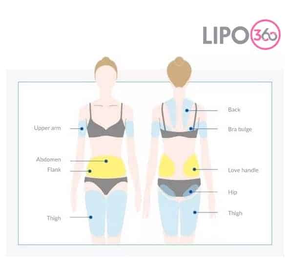 Various Areas of the Body We Treat with Cryolipolysis Andover 	