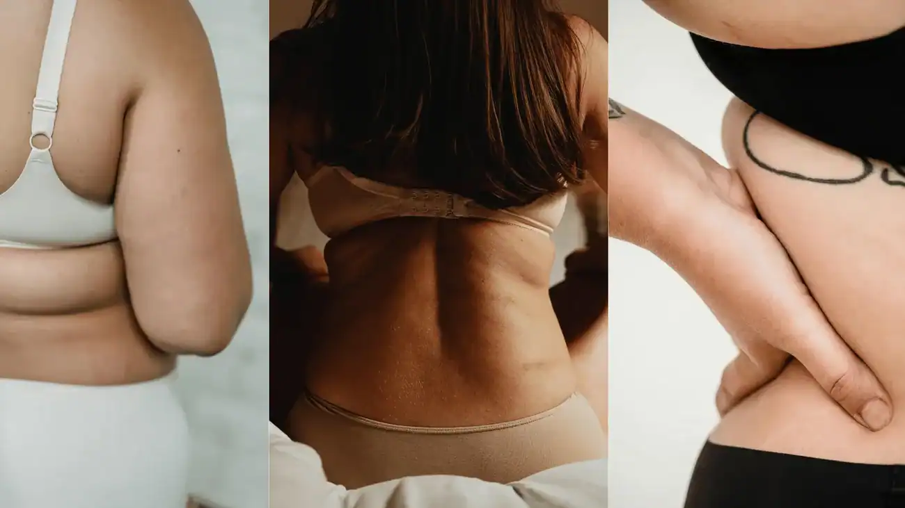 Frequently Asked Questions diastasis recti