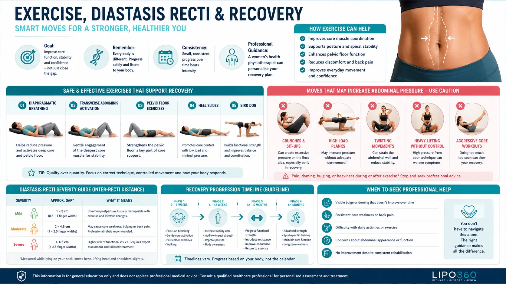 Does Exercise Reduce the Risk of Diastasis Recti?