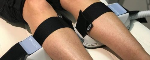 LIPO360 Body Sculpt Areas We Treat Andover 	 Calves (Lower Legs)